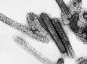 etiopia-registra-primeiro-surto-de-doenca-‘prima’-do-ebola