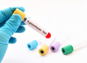 primeiro-antibiotico-em-decadas-contra-gonorreia-e-aprovado-apos-decadas-sem-inovacoes