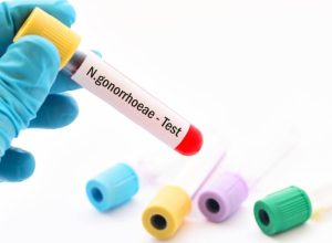 novo-antibiotico-contra-gonorreia-e-aprovado-apos-decadas-sem-inovacoes