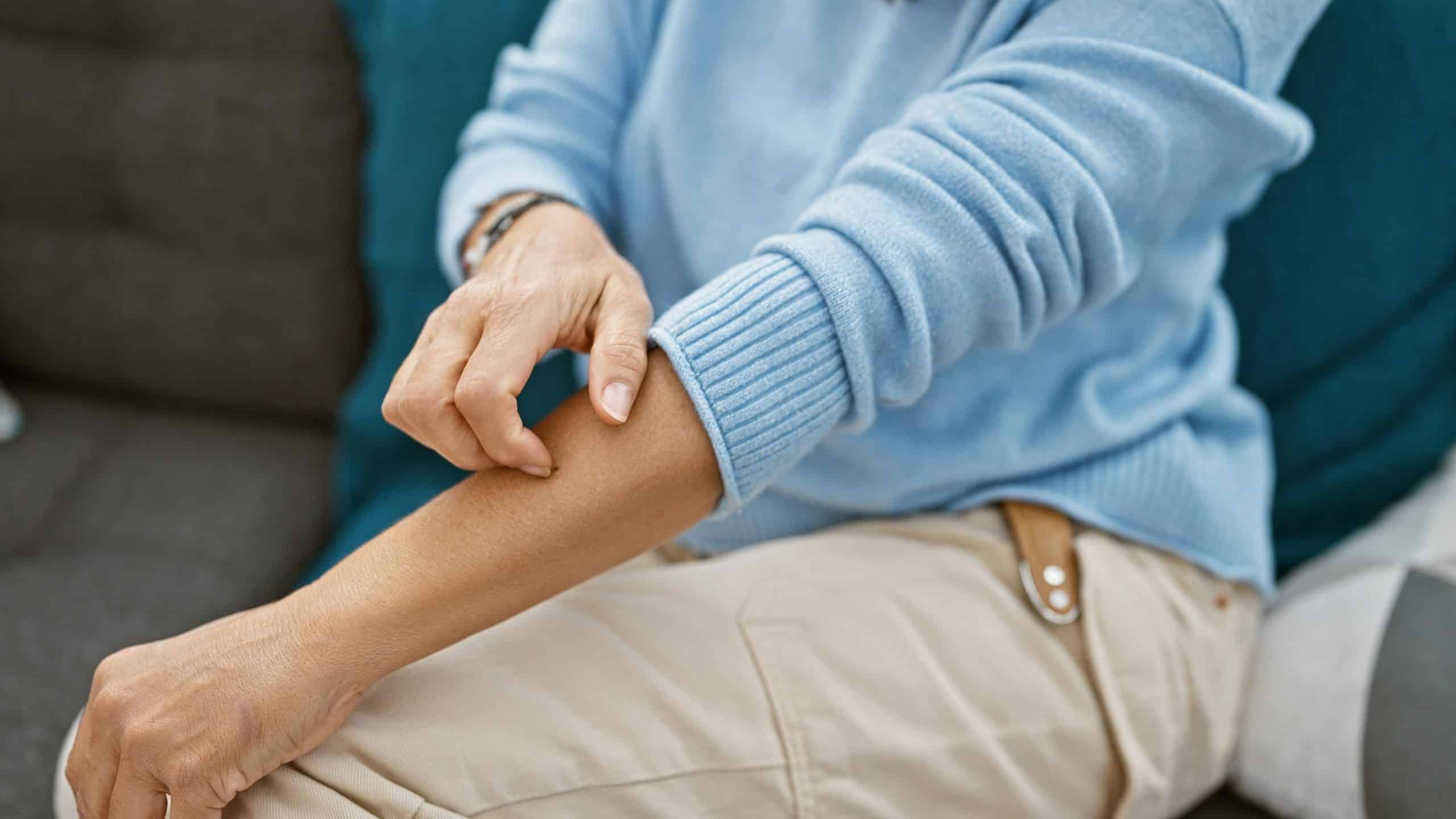 por-que-sentimos-coceira-so-de-ver-alguem-se-cocando?