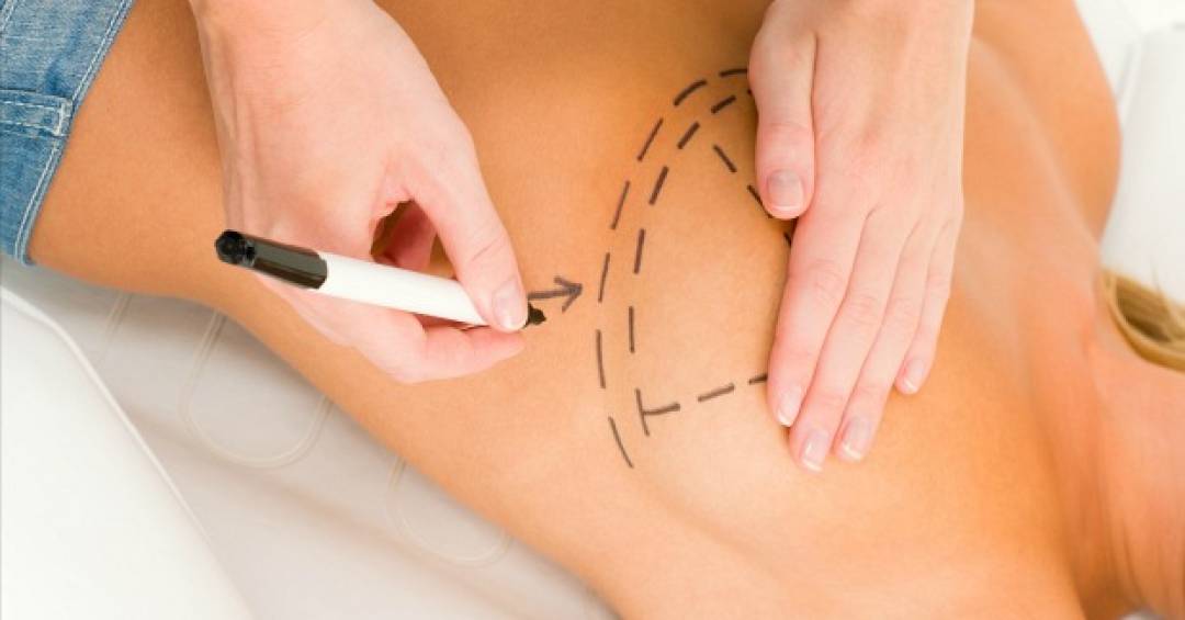 como-se-recuperar-bem-de-uma-cirurgia-plastica?