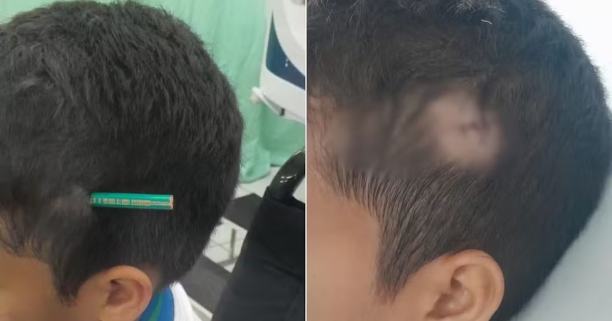 estudante-finca-lapis-na-cabeca-de-colega-durante-briga-em-escola-no-litoral-de-sao-paulo