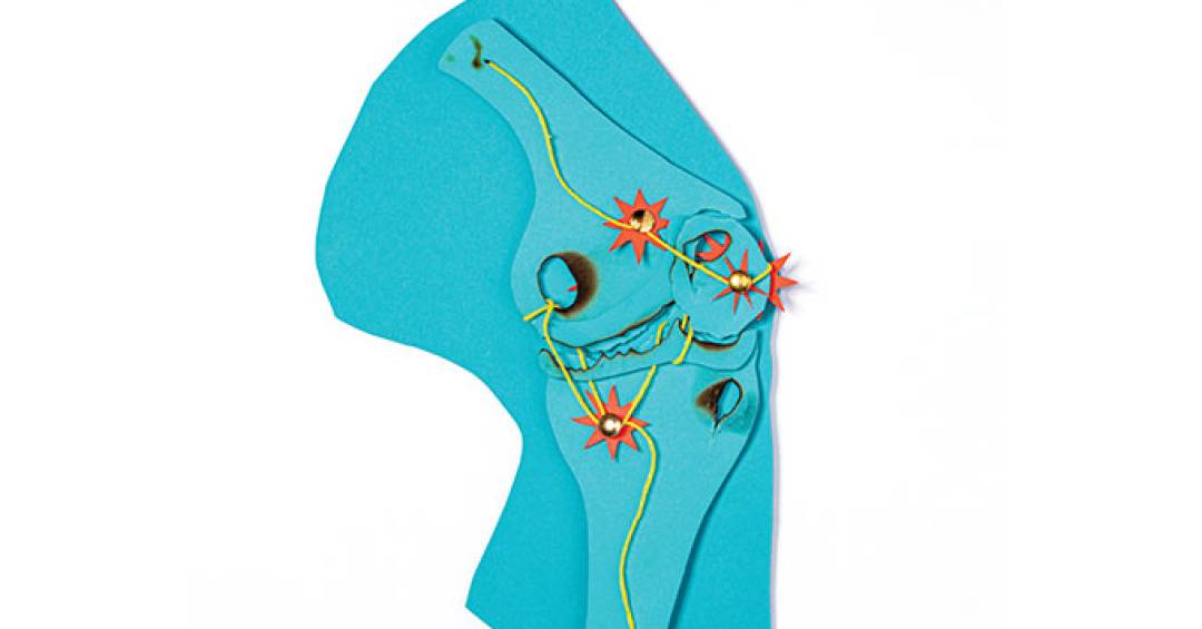 esses-sao-os-melhores-exercicios-para-artrose-no-joelho,-revela-estudo