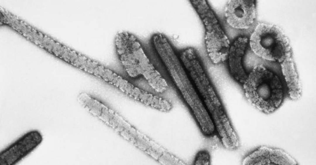 etiopia-registra-primeiro-surto-de-doenca-‘prima’-do-ebola
