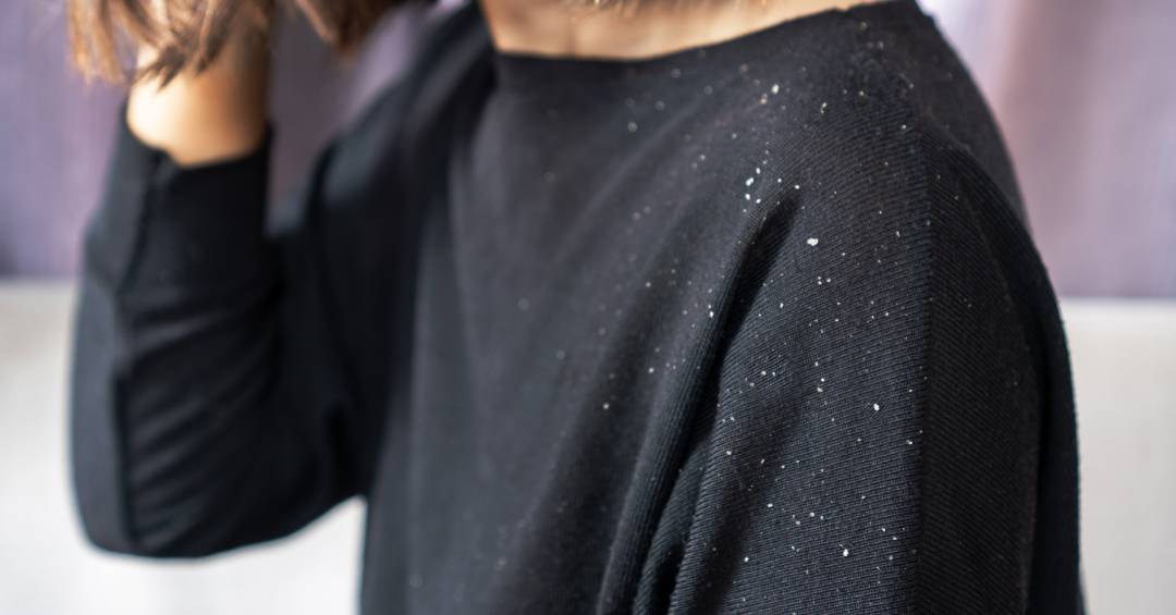 caspa-pode-ser-diferente-em-homens-e-mulheres:-o-que-muda-no-tratamento?