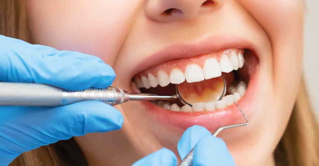 da-boca-para-o-corpo:-novos-estudos-disparam-alerta-sobre-dentes-em-mau-estado