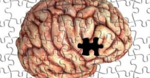 alzheimer:-entenda-os-estagios-da-doenca-que-afeta-ex-presidente-fhc